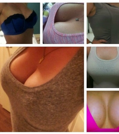 breast enlargement pretoria-min breast-enlargement