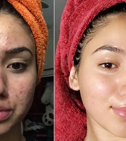 skin lightening joburg-min skin whitening cream