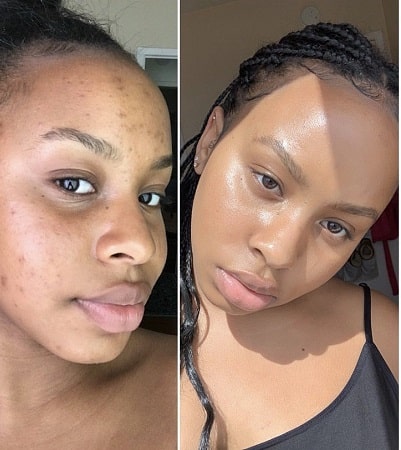 skin lightening-min skin-lightening-cream