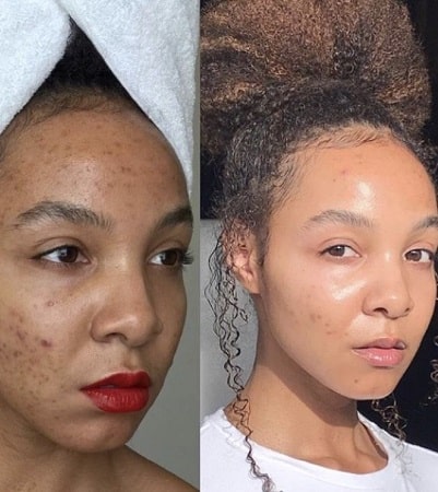 skin lightening pretoria-min skin-lightening-cream