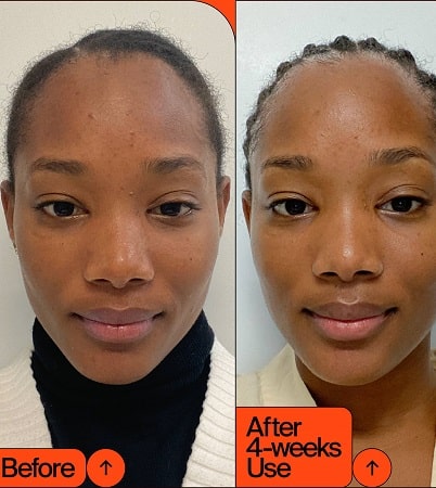 skin-whitening-min